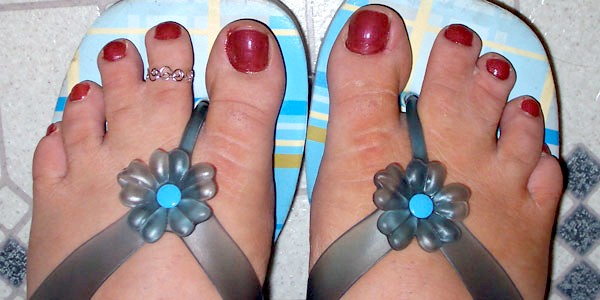 JRS webbed toes
