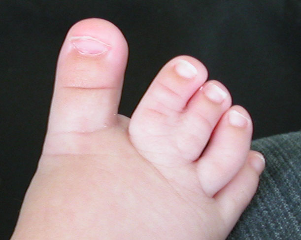 New Zealand baby girl's toes